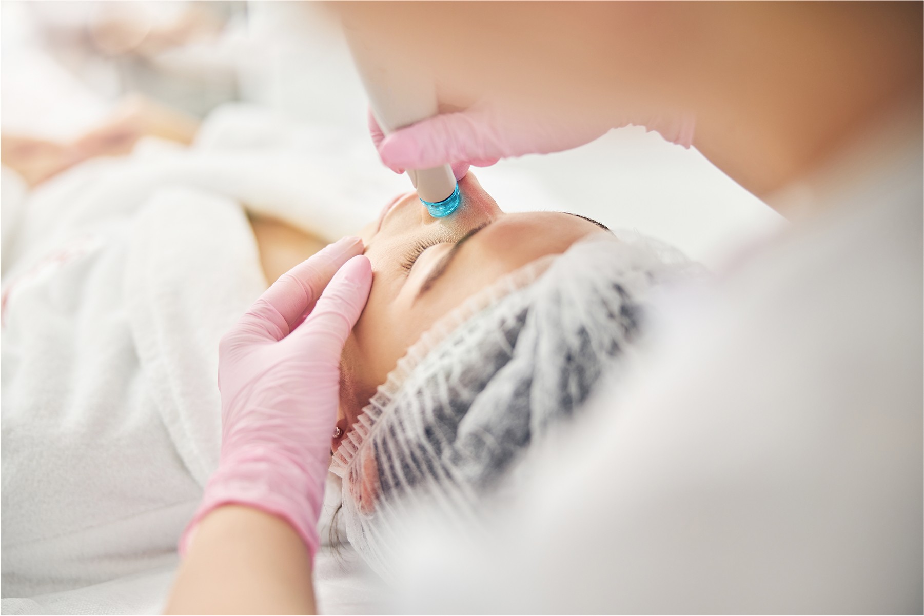 Chemical peel