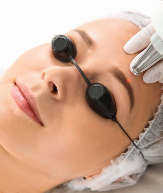Eyebrow tattoo removal