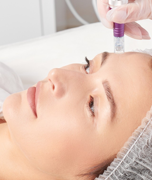 Microneedling